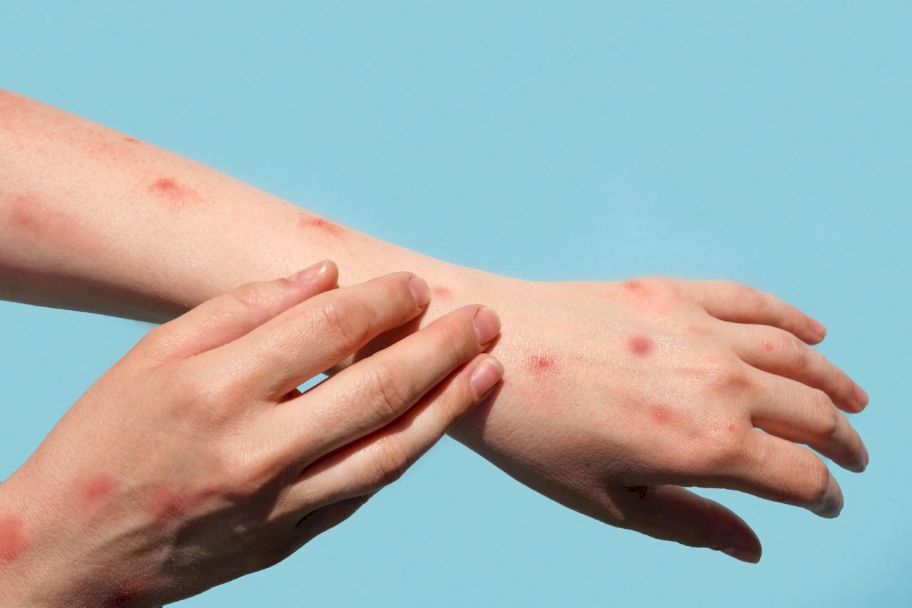 衛生福利部疾病管制署は7日夜、国内で初めて児童のサル痘の感染例が確認されたと発表した。（写真：Unsplash）